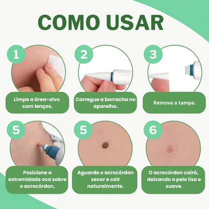 Meu Tag - Kit para remoção de verrugas na pele